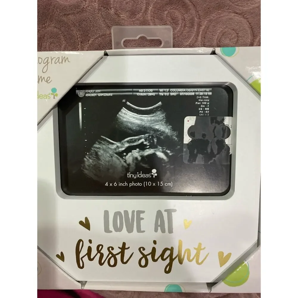 Baby Sonogram Picture Frame New